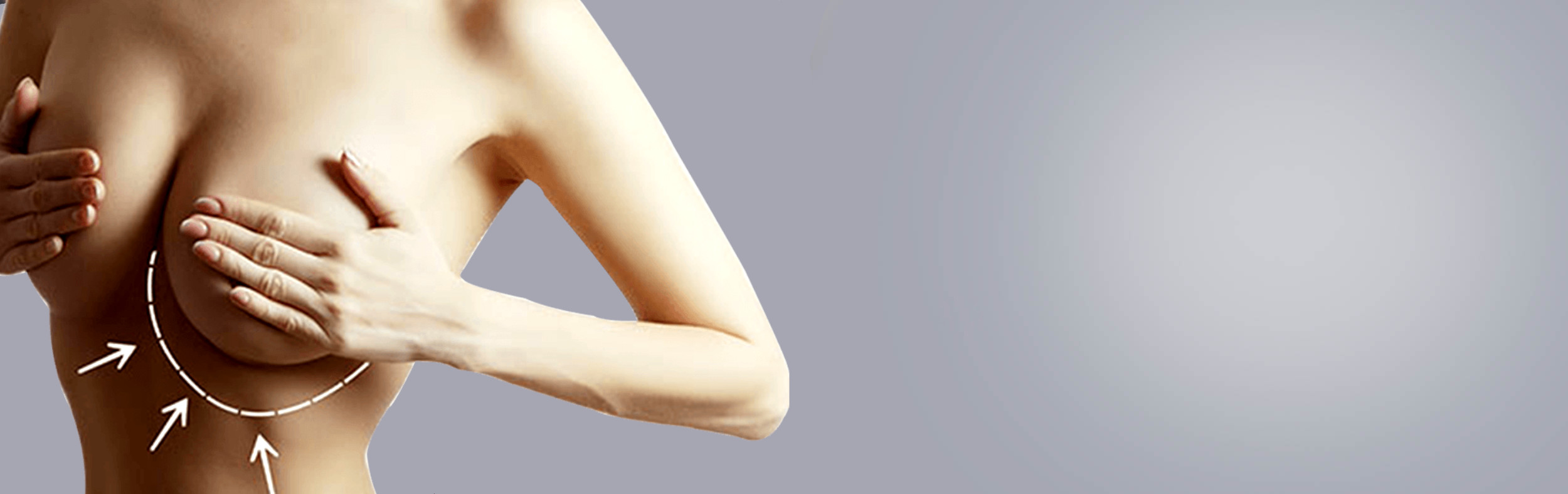 Augmentation mammaire
